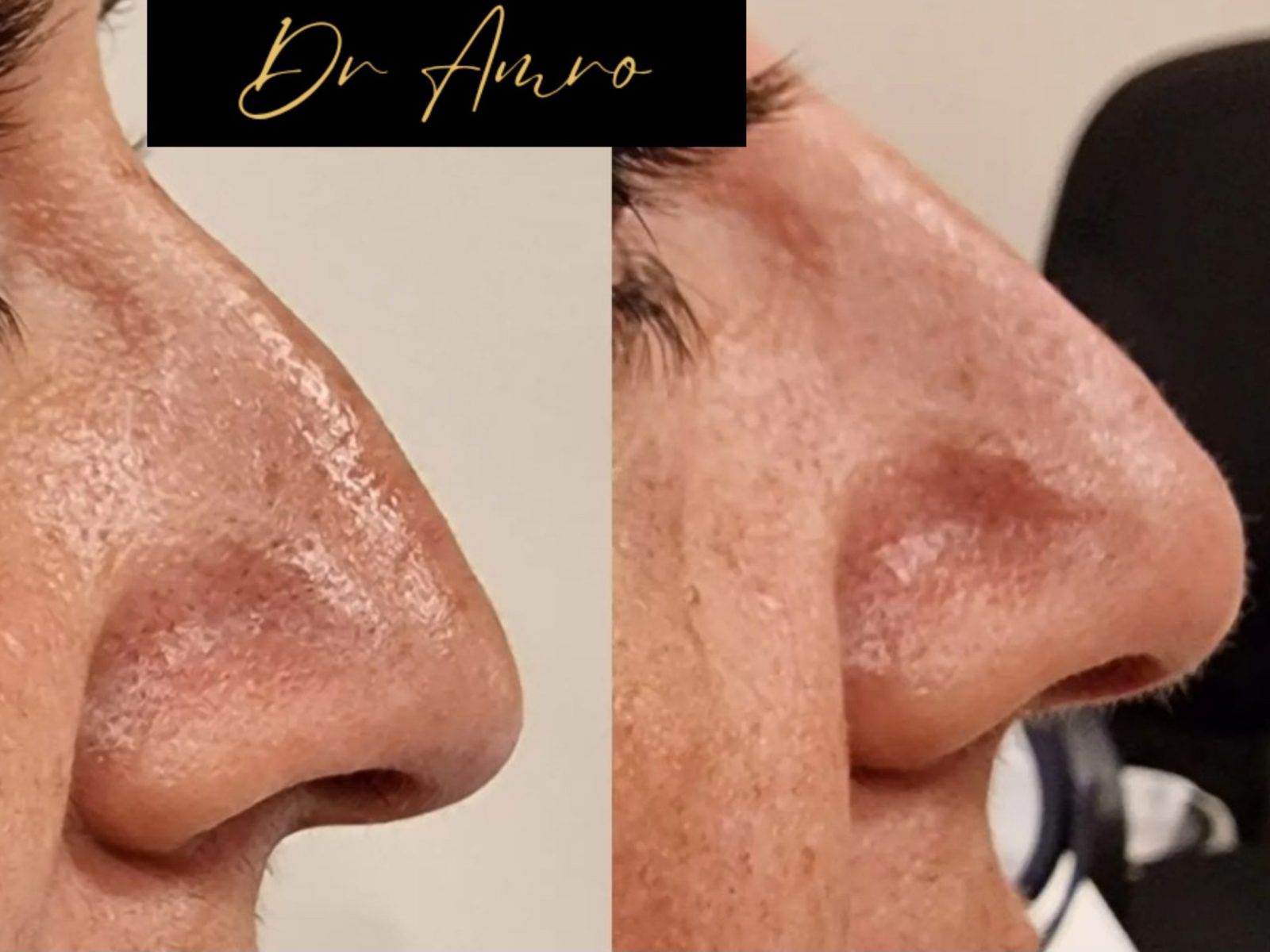 Aesthetics Preston Lytham